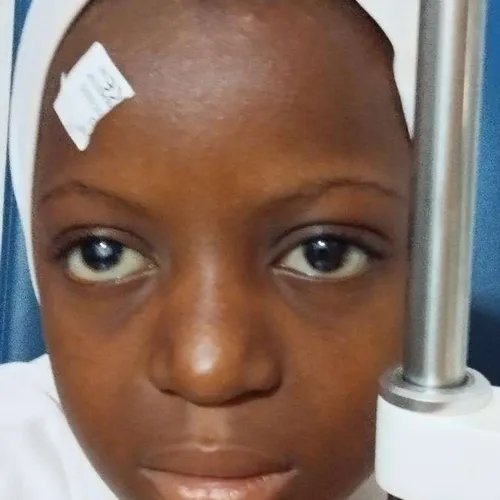 Child after eye surgery in West Africa